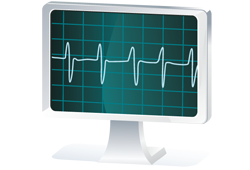 EKG